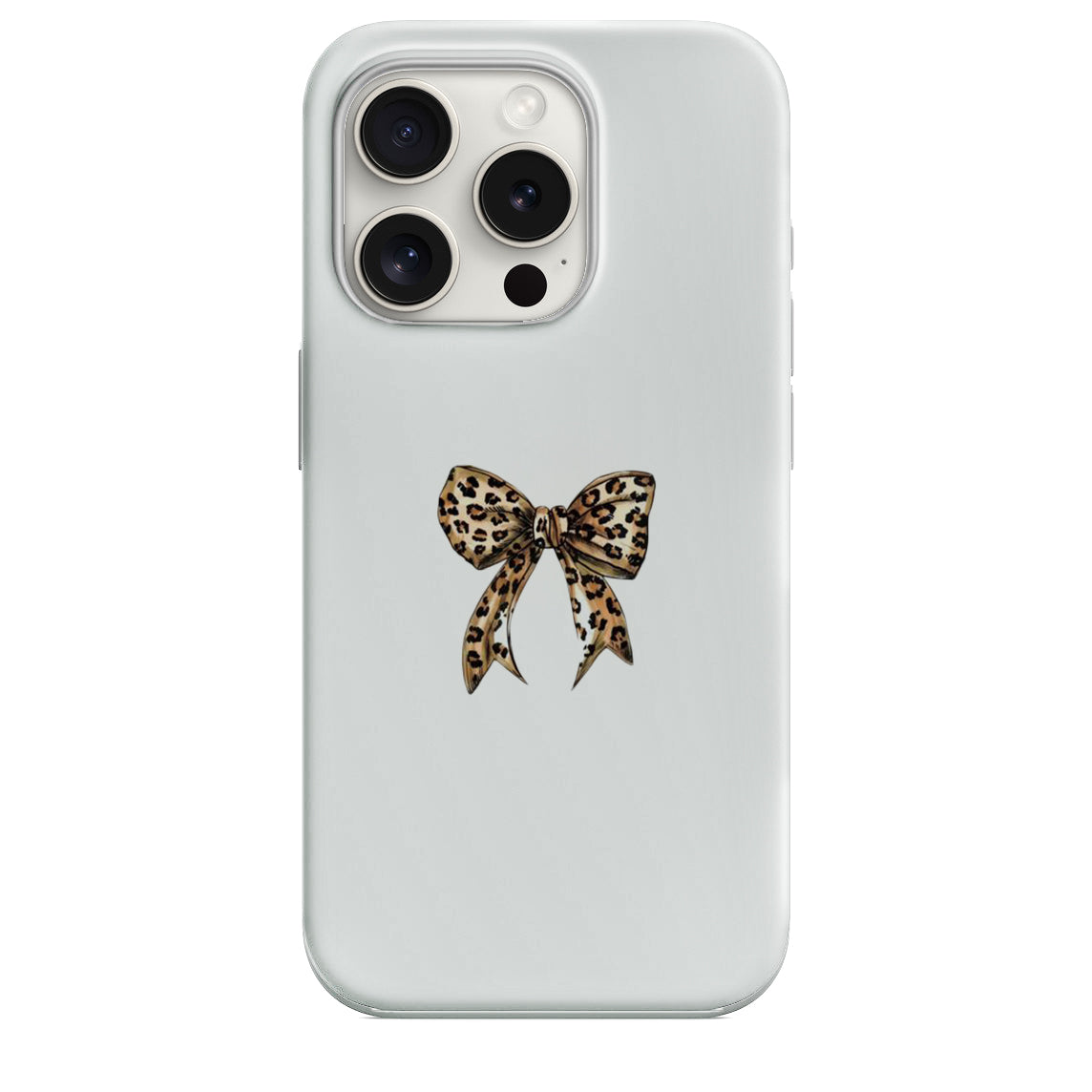Fiyonk Leopar Desenli Lüx Premium Telefon Kılıfı -- 133